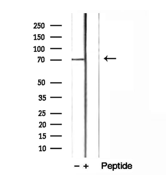 MAC-2-BP / LGALS3BP Antibody