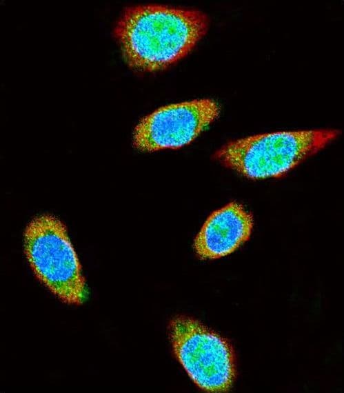 SUMO1 / SMT3 Antibody