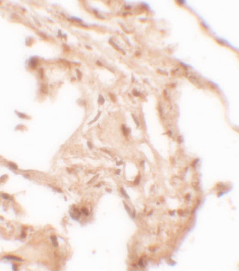 Polyclonal Rabbit anti-Human WFDC2 / HE4 Antibody (IHC, IF, WB)