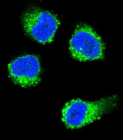 Polyclonal Rabbit anti-Human NGF Antibody (aa84-115, IHC, IF, WB)