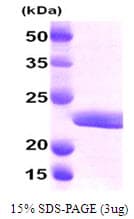 Human MYL2 Protein (Recombinant His)