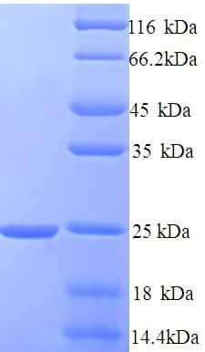 Human HN1 / ARM2 Protein (Recombinant His)