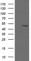 TAPBPL / TAPBPR Antibody (clone OTI2A4)