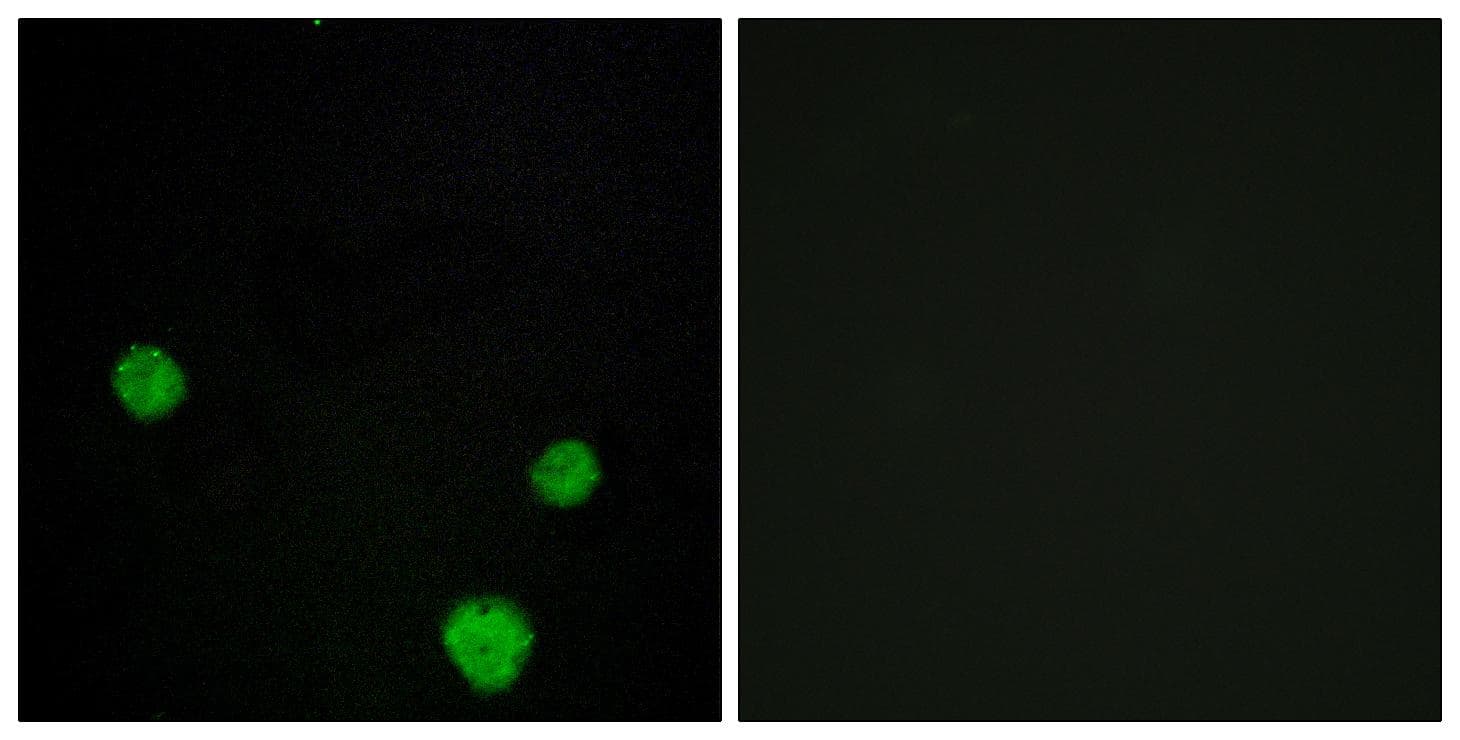 HLX1 / HLX Antibody
