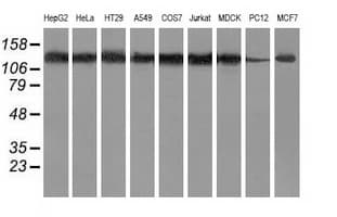 HDAC6 Antibody (clone OTI4C5)