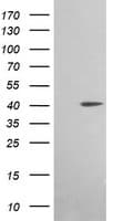 ACAA2 Antibody (clone OTI1B1)