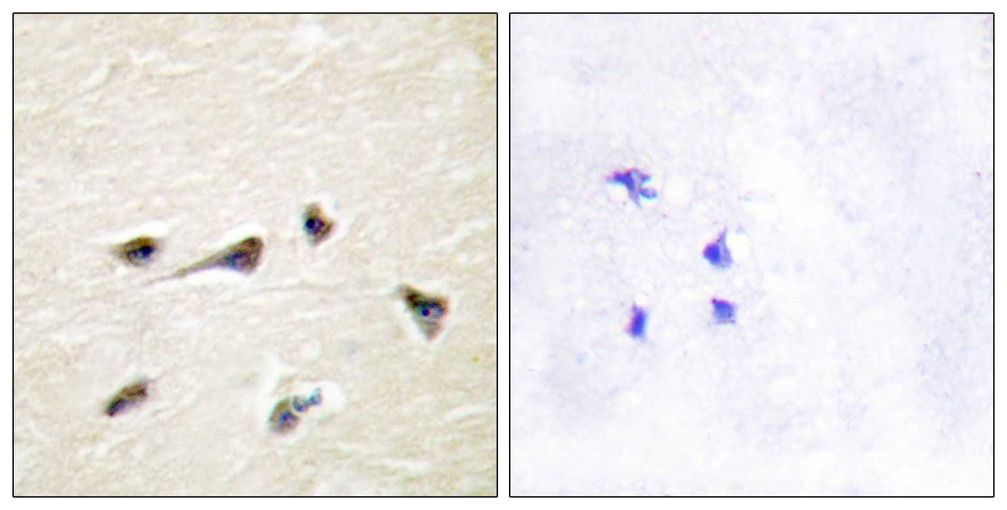 Gravin / AKAP12 Antibody (aa301-350)