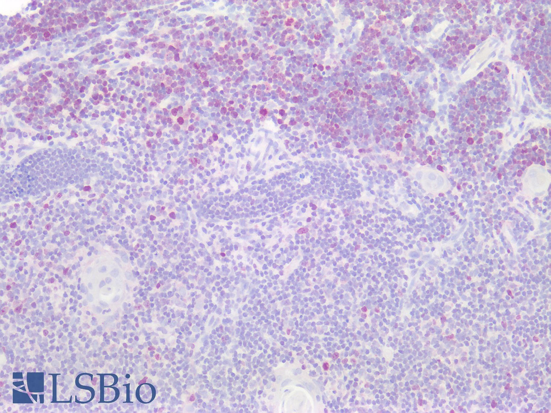 IHC-plus™ MKI67 / Ki67 Antibody