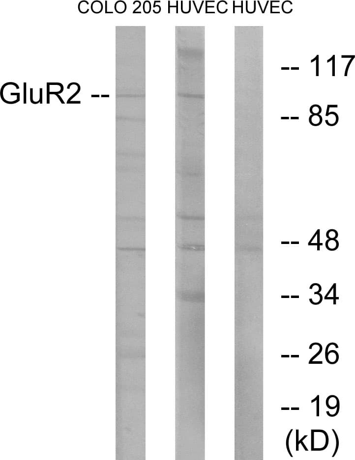 Polyclonal Rabbit anti-Human GRIA2 / GLUR2 Antibody (aa834-883, IHC, WB)