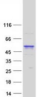 Human ANKFY1 Protein (Recombinant Myc-DDK (Flag))