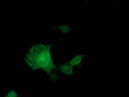 ADH2 / ADH1B Antibody (clone OTI1C3)