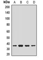 NACA Antibody