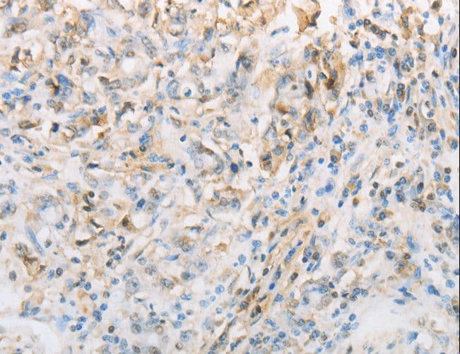 NPPC Antibody