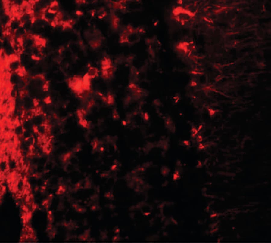 IHC-plus™ LRRTM2 Antibody