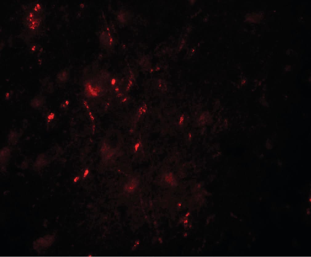 IHC-plus™ BRN2 / POU3F2 Antibody