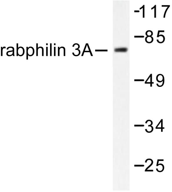 Polyclonal Rabbit anti-Human RPH3A / Rabphilin 3A Antibody (Pro231, IHC, IF, WB)