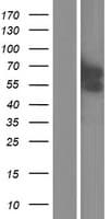 GCM2 Protein (Over-Expression Lysate Myc-DDK (Flag))