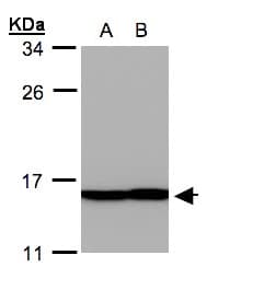 PFN2 / Profilin 2 Antibody (aa1-90)