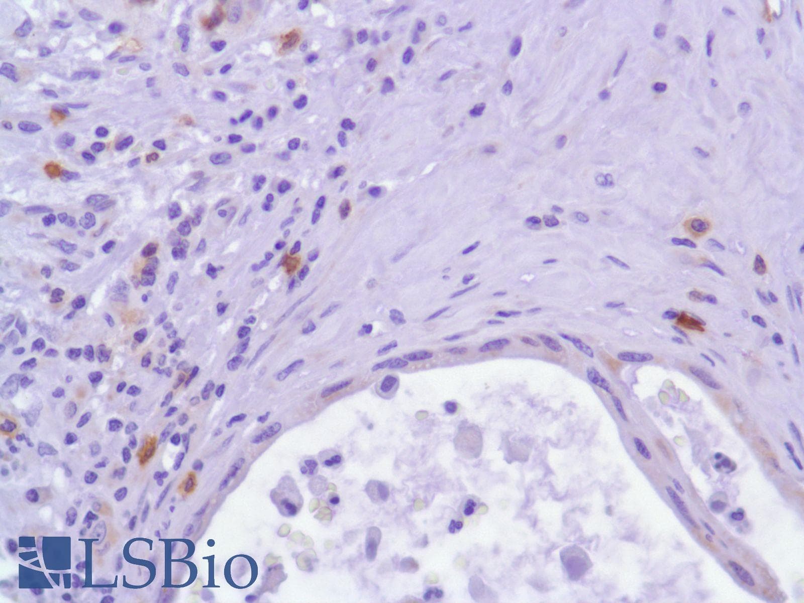 ICOS / CD278 Antibody (C-Terminus, clone SP98)