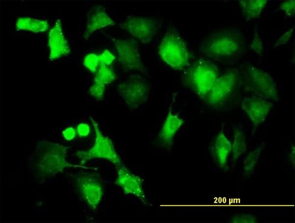 Monoclonal Mouse anti-Human PPM1B Antibody (clone 1A3-2A4, IF, WB)