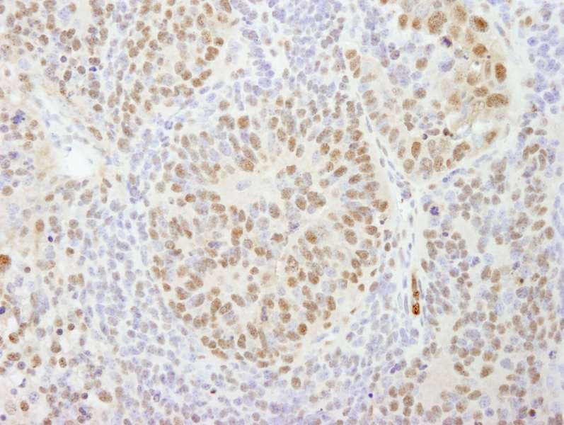 Polyclonal Rabbit anti-Human CPSF160 / CPSF1 Antibody (aa1392-1442, IHC, IF)
