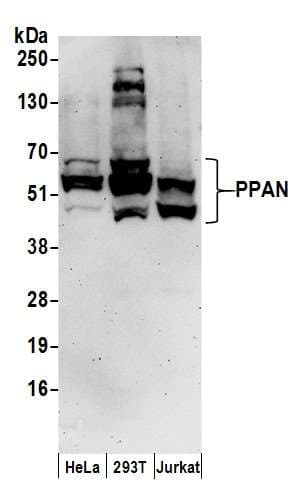 Polyclonal Rabbit anti-Human PPAN Antibody (aa375-425, WB)