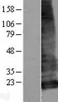 LHFPL5 Protein (Over-Expression Lysate Myc-DDK (Flag))