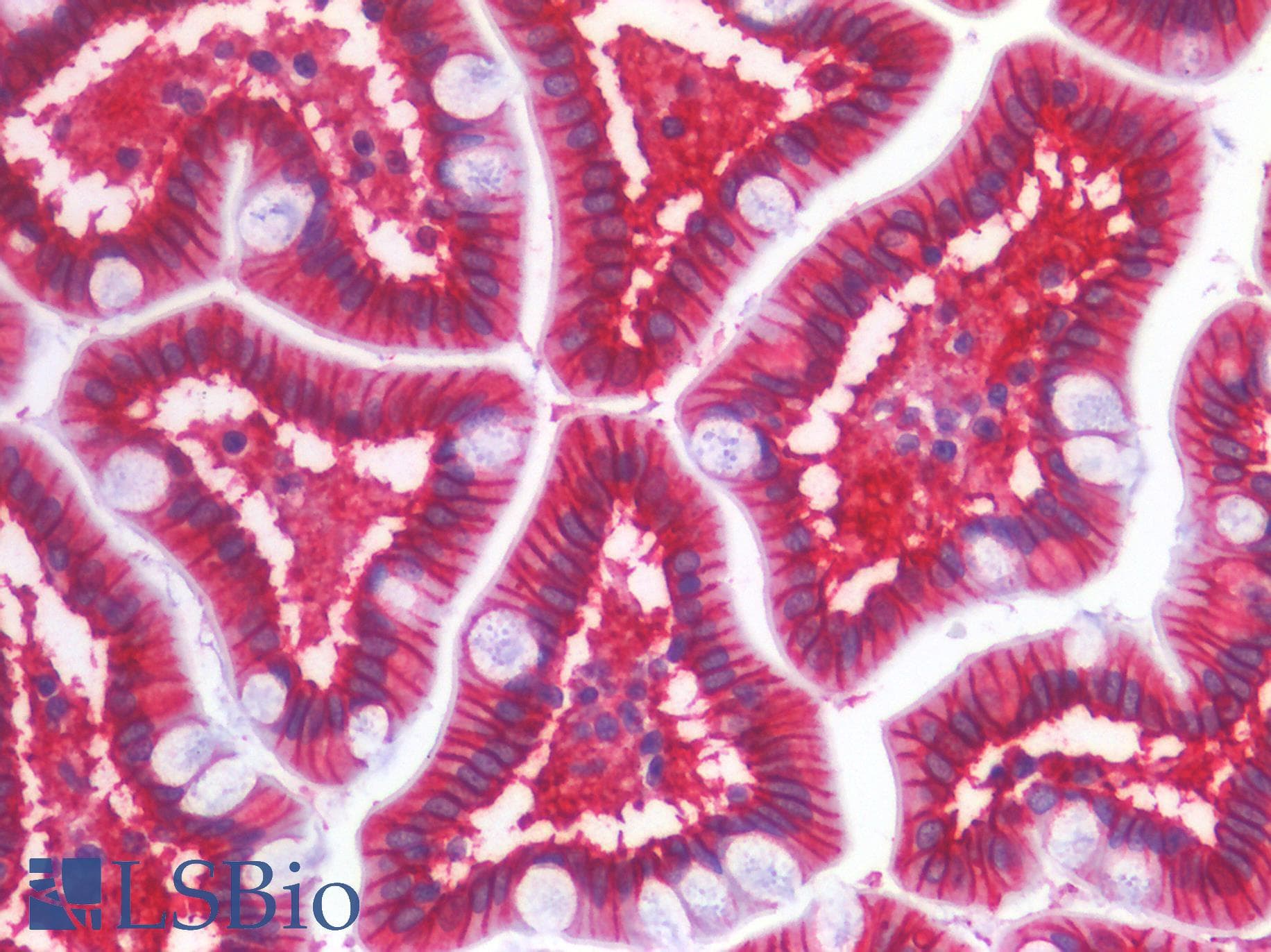 PathPlus™ CDH17 / Cadherin 17 Antibody (clone 3H2)