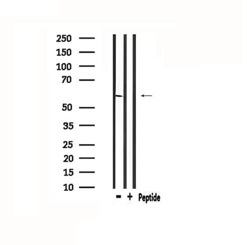 Polyclonal Rabbit anti-Human BAG3 / BAG-3 Antibody (IHC, WB)