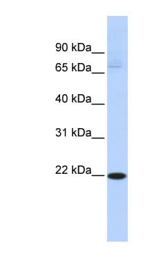 RBPMS2 Antibody (C-Terminus)