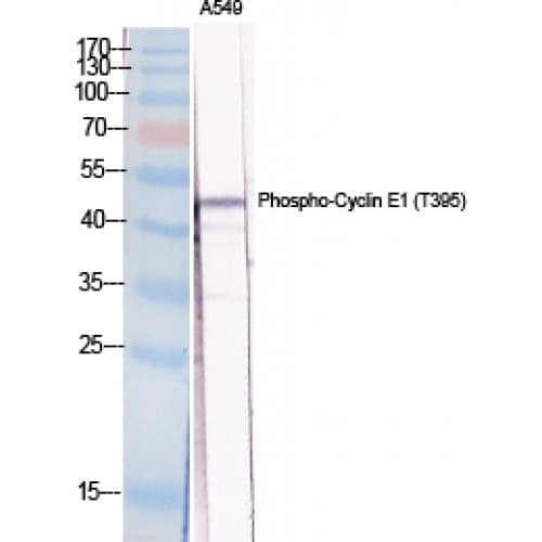 Polyclonal Rabbit anti-Human CCNE1 / Cyclin E1 Antibody (330-410 aa, IHC, WB)