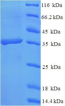 Human CLEC4D / MCL Protein (Recombinant 6His-SUMO, N-terminus)