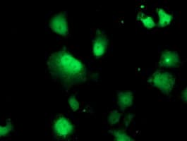 Thymidylate Kinase Antibody (clone OTI1C4)