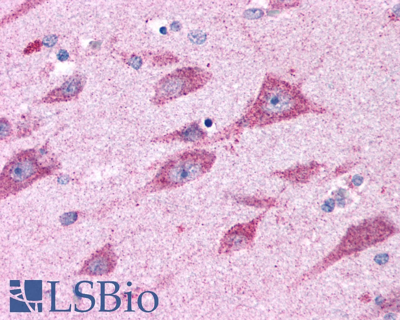 PathPlus™ CELSR2 Antibody (N-Terminus)