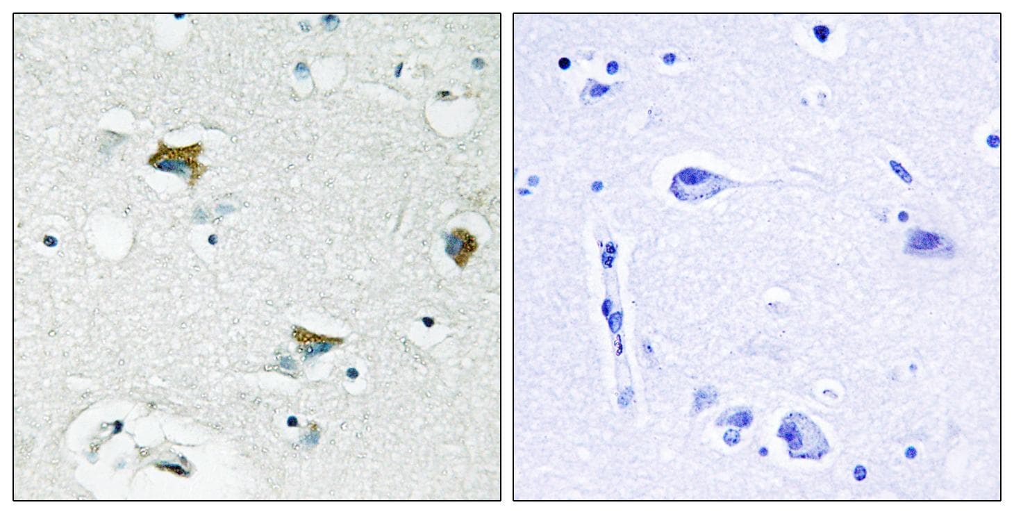 BAD Antibody (aa61-110)