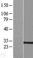 Human HACD2 / PTPLB Protein (Over-Expression Lysate Myc-DDK (Flag))