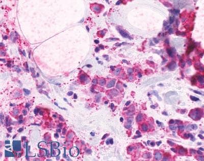 PathPlus™ CELSR2 Antibody (N-Terminus)
