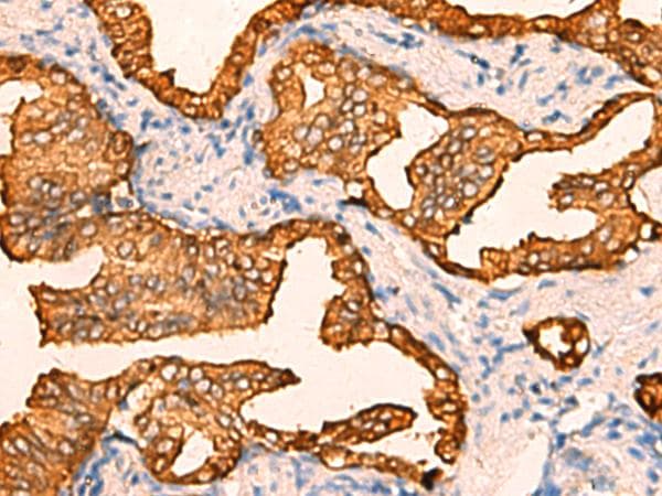 CRYM Antibody