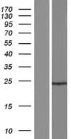 C17orf105 Protein (Over-Expression Lysate Myc-DDK (Flag))