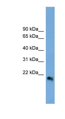 IFN Beta / Interferon Beta Antibody (aa107-156, HRP)