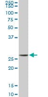 MTAP Antibody (clone 2G4)