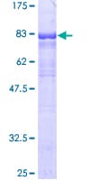 Human GDI1 Protein (Recombinant GST)