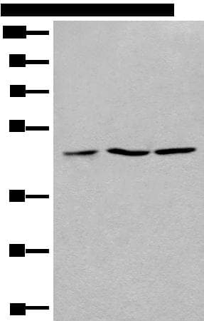 Polyclonal Rabbit anti-Human RPL3 / Ribosomal Protein L3 Antibody (WB)