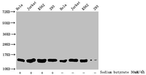 Polyclonal Rabbit anti-Human HIST1H2BN Antibody (IHC, IF, WB)