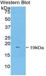 F2 / Prothrombin / Thrombin Antibody (aa44-200)