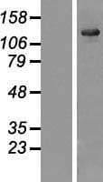 USP25 Protein (Over-Expression Lysate Myc-DDK (Flag))