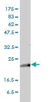 Monoclonal Mouse anti-Human KRAS Antibody (clone 3B10-2F2, IF, WB)