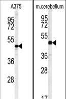 CACUL1 / Cullin Antibody (aa326-354)