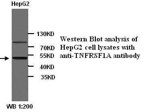 TNFRSF1A / TNFR1 Antibody (N-Terminus)
