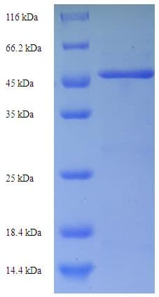 Human TNFRSF21 / DR6 Protein (Recombinant His-SUMO)